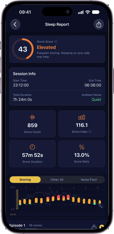 Sleep Report